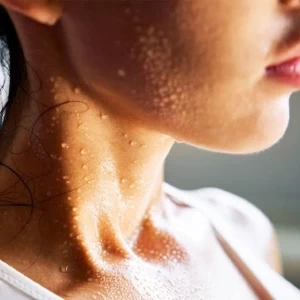 چرا آدم های خجالتی بیشتر عرق میکنند؟